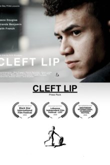  Заячья губа (2017) Cleft Lip